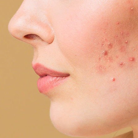 ➡️ Séance suite PD13 Thérapy