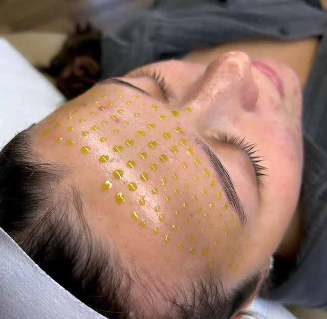 SOONSU SHINING PEELING