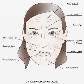 Rides du front complet