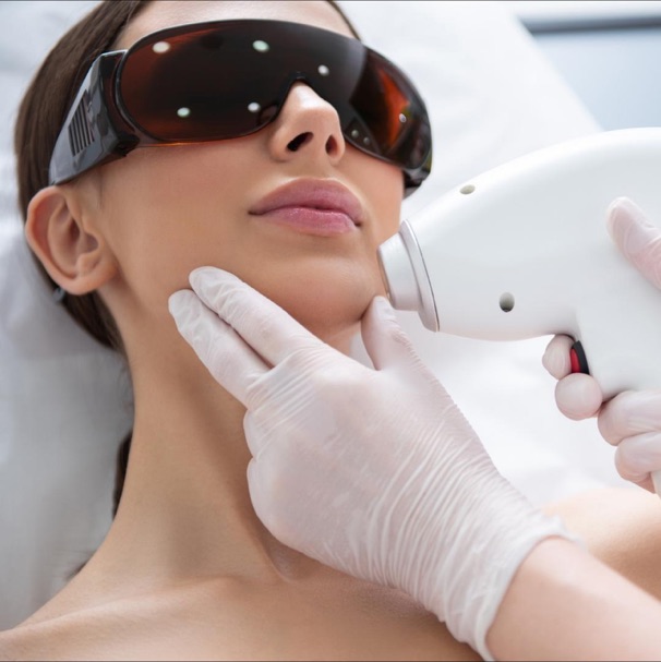 Épilation définitive Visage complet (joue, pas de cheveux, duvet, menton, bas, menton)