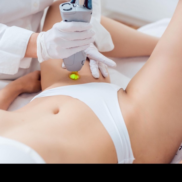 Epilation définitive Maillot Simple