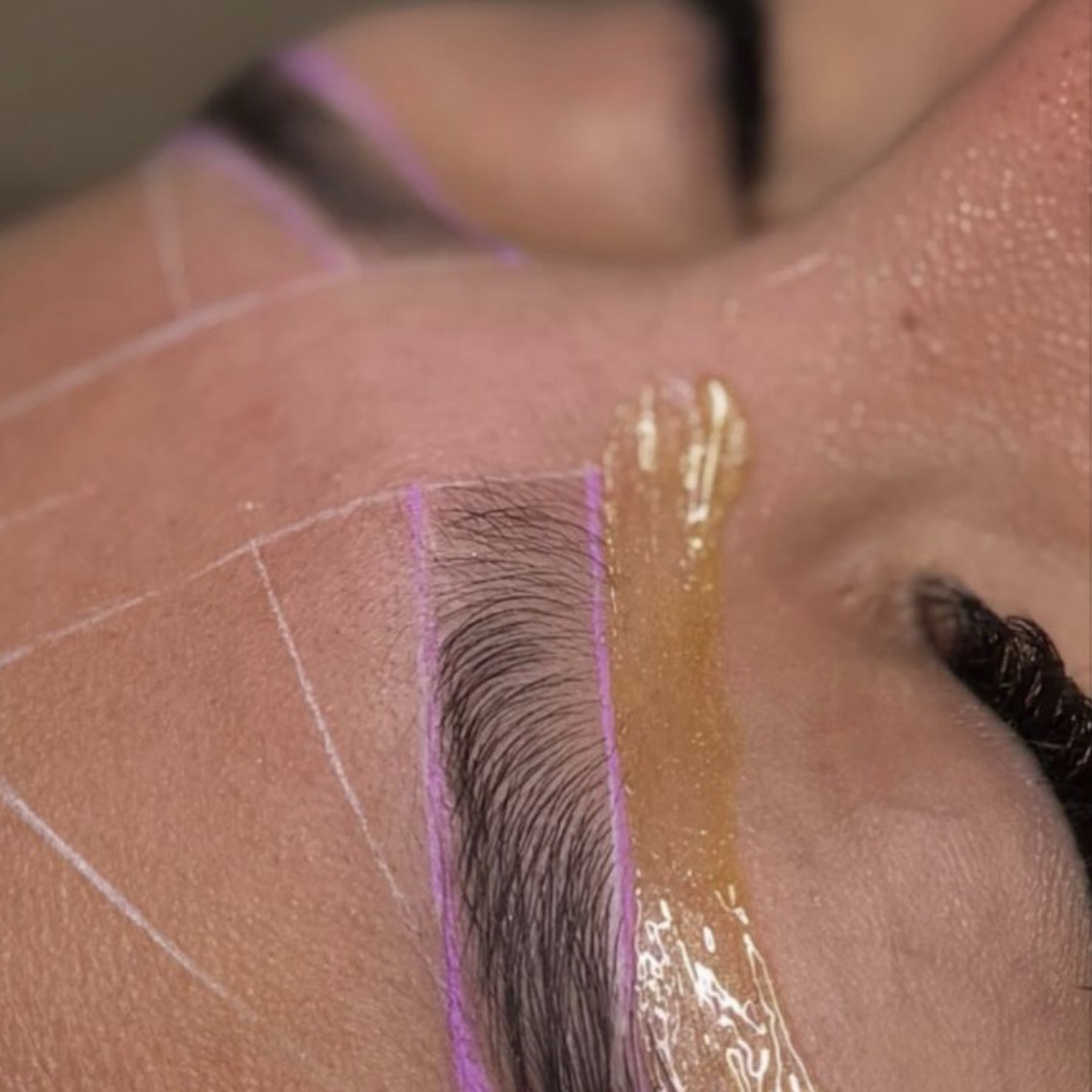 Brow Shaping (Epilation)