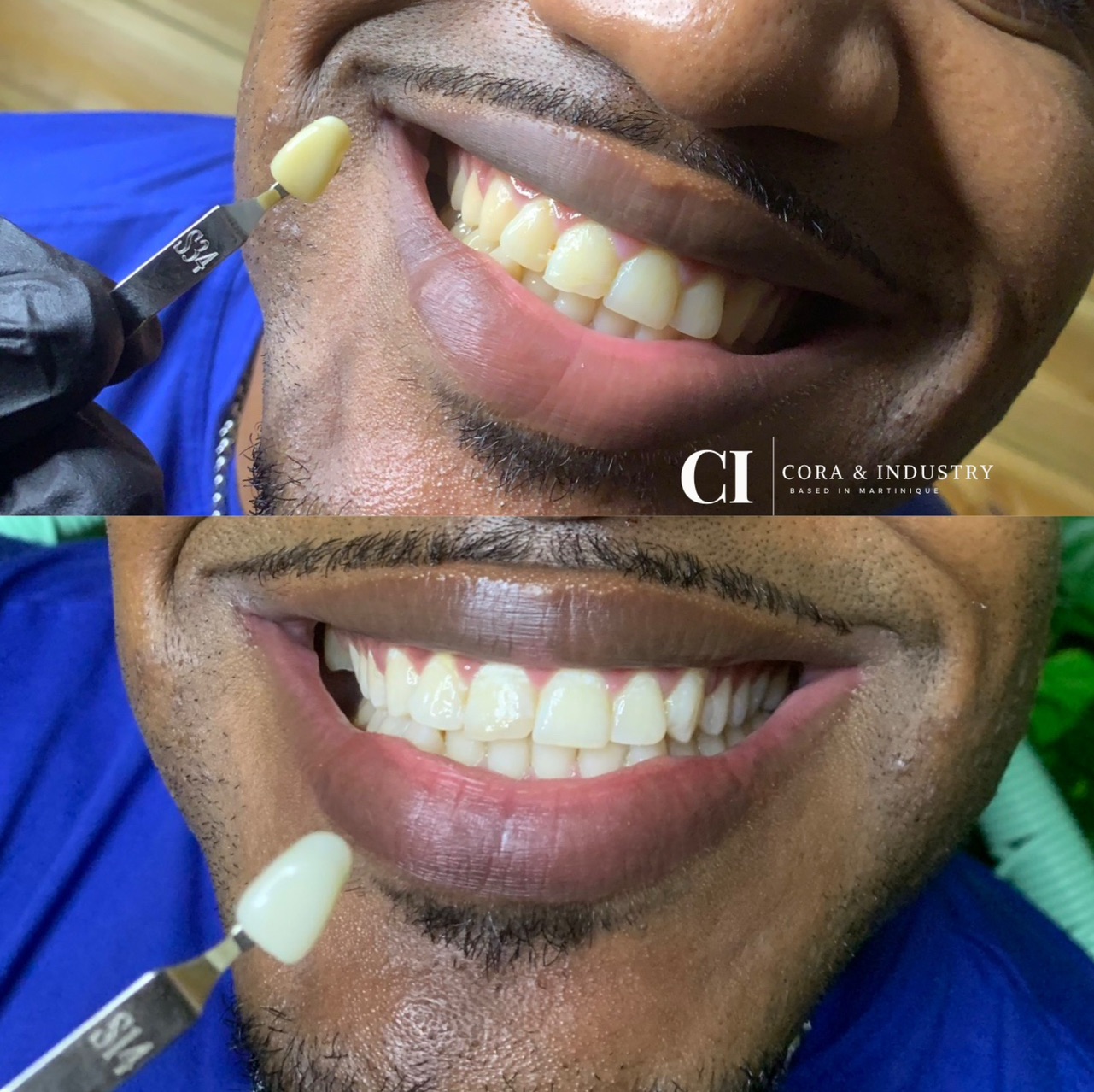 Formule Glow | 3 séances de 1H