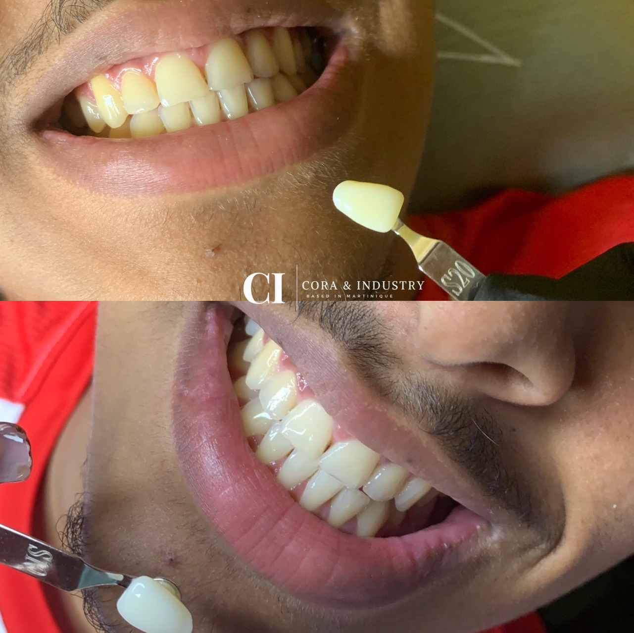 Formule Shine | 1 séance de 1H