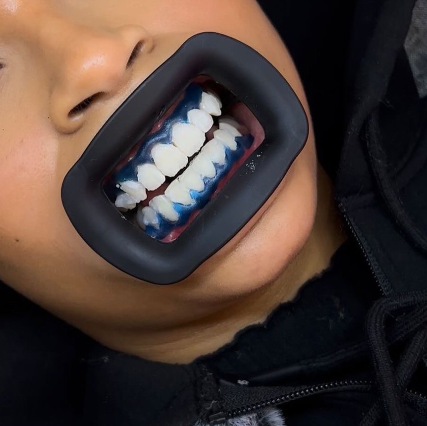 Blanchiment dents White